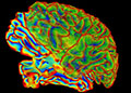 brain surface map